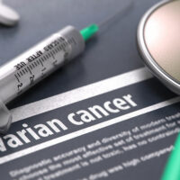 A Comprehensive Guide on Ovarian Cancer