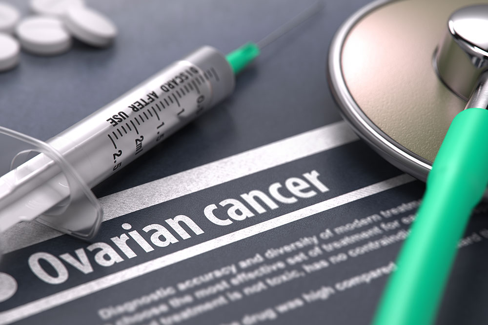 A Comprehensive Guide on Ovarian Cancer