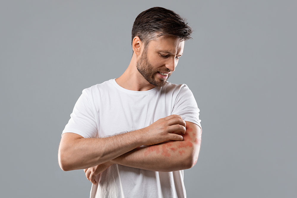 Effective Home Remedies for Dermatitis