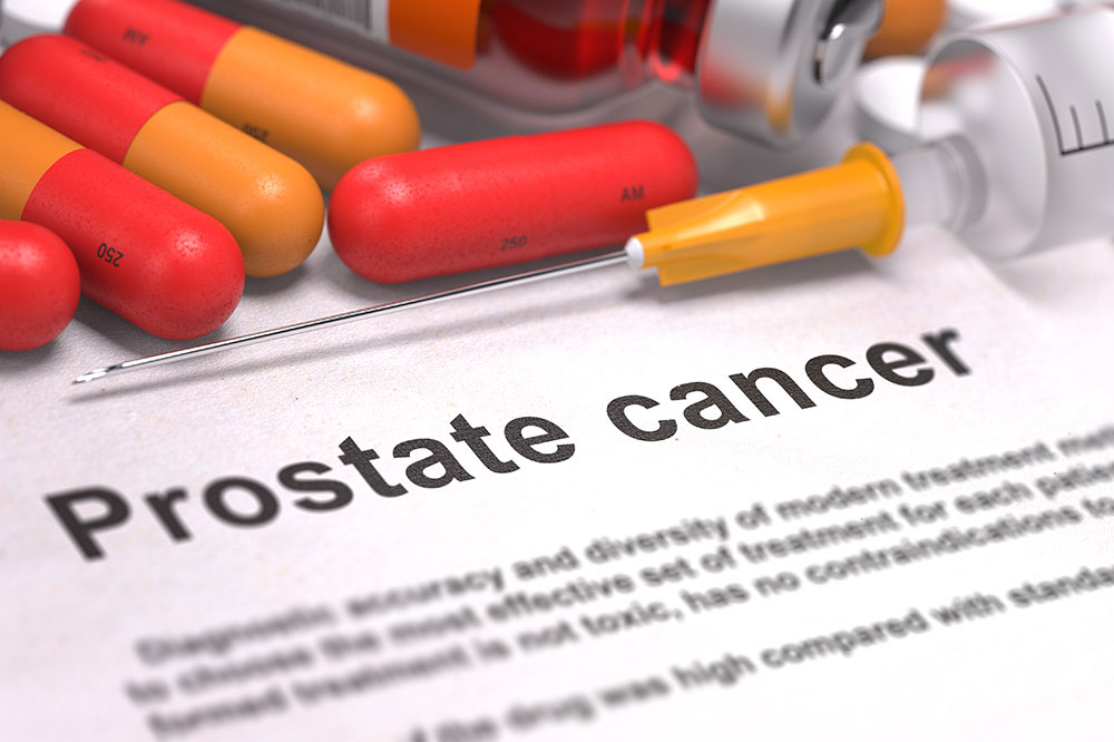Prostate Cancer – Stages and Diagnostics